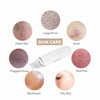 Ultrasonic Skin Scrubber | Deep Cleans Pores and Unveils Radiant Skin in Just 3 Minutes