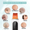 Ultrasonic Ion Cleaner | Deep Cleans Pores and Restores Radiant Skin in 93% of Women in Just 3 Days