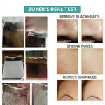 Ultrasonic Ion Cleaner | Deep Cleans Pores and Restores Radiant Skin in 93% of Women in Just 3 Days