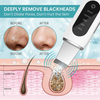 Ultrasonic Ion Cleaner | Deep Cleans Pores and Restores Radiant Skin in 93% of Women in Just 3 Days