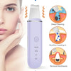 Ultrasonic Skin Scrubber | Deep Cleans Pores and Unveils Radiant Skin in Just 3 Minutes